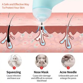 Vacuum Blackhead Machine, Reduce Spots Mini Handheld Lifting Massage Facial Blackhead Remover for Skin Care